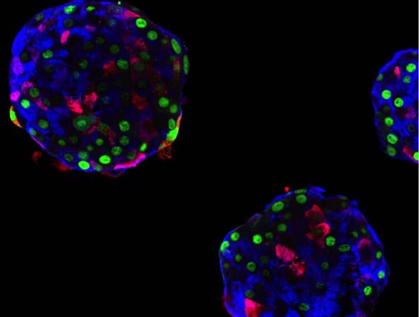 Pseudo-islotes compuestos por células alfa humanas. Estas células producen glucagón (azul), pero pueden «aprender» a producir insulina (rojo). La proteína GFP (verde) permite rastrear el origen de las células, certificando así su cambio de identidad.
