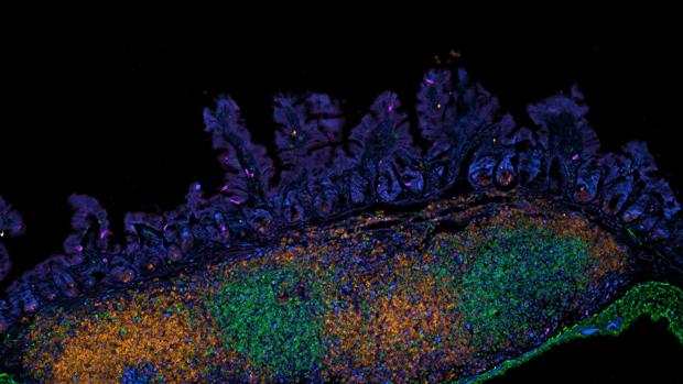 La imagen muestra una imagen de microscopio confocal de células inmunes en el revestimiento epitelial del intestino de un ratón joven.