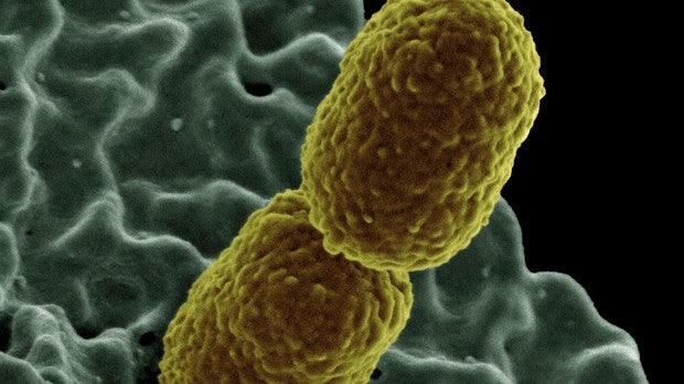 Klebsiella pneumoniae